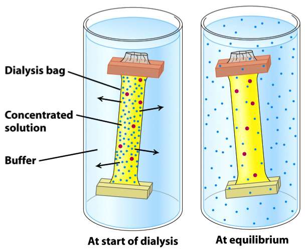 dialysis.jpg